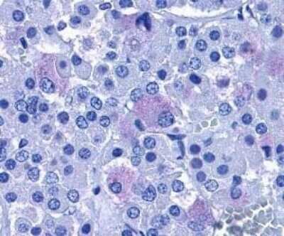 Immunohistochemistry-Paraffin: PAC1R Antibody - BSA Free [NLS948]