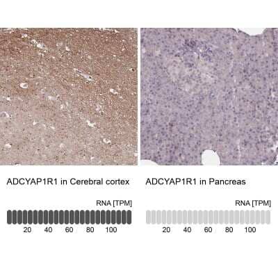 Immunohistochemistry-Paraffin: PAC1R Antibody [NBP2-47340]