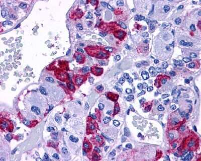 Immunohistochemistry-Paraffin: PAC1R Antibody - BSA Free [NLS946]