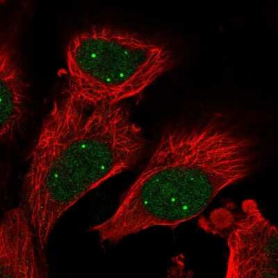 Immunocytochemistry/ Immunofluorescence: PAC2 Antibody [NBP2-30574]