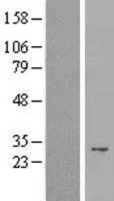 Western Blot: PAC2 Overexpression Lysate [NBL1-14912]