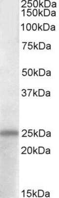 Western Blot: PACAP/ADCYAP1 Antibody [NBP1-51959]