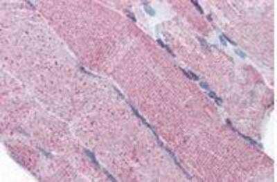 Immunohistochemistry-Paraffin: PACE4/PCSK6 Antibody [NBP1-02307]