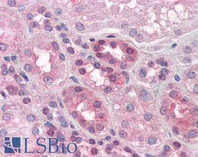 Immunohistochemistry-Paraffin: PACE4/PCSK6 Antibody [NBP1-02307]