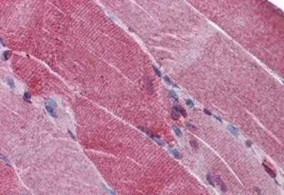 Immunohistochemistry-Paraffin: PACE4/PCSK6 Antibody [NBP1-05030]