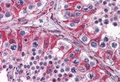 Immunohistochemistry-Paraffin: PACE4/PCSK6 Antibody [NBP1-05030]