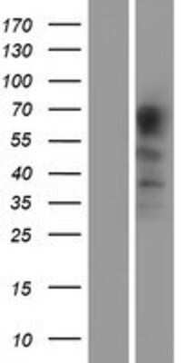 Western Blot: PACE4/PCSK6 Overexpression Lysate [NBP2-05676]