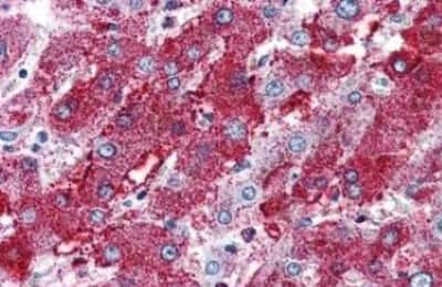 Immunohistochemistry-Paraffin: PACE4/PCSK6 Antibody [NBP3-14443]