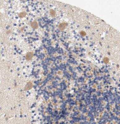 Immunohistochemistry-Paraffin: PACE4/PCSK6 Antibody [NBP1-87354]