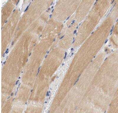 Immunohistochemistry-Paraffin: PACE4/PCSK6 Antibody [NBP1-87354]