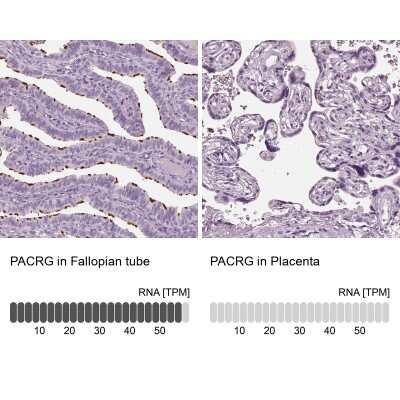 Immunohistochemistry-Paraffin: PACRG Antibody [NBP2-55838]