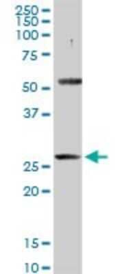 Western Blot: PACRG Antibody [H00135138-D01P]