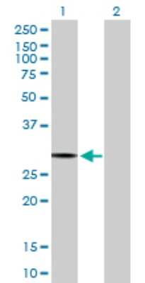 Western Blot: PACRG Antibody [H00135138-D01P]