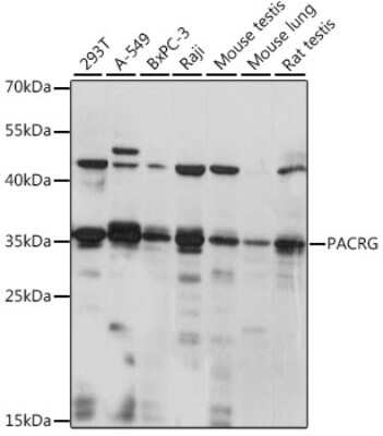 Western Blot: PACRG AntibodyAzide and BSA Free [NBP2-94445]