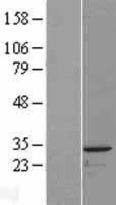 Western Blot: PACRG Overexpression Lysate [NBL1-14058]