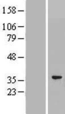 Western Blot: PACRG Overexpression Lysate [NBP2-05382]