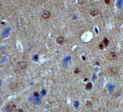 Immunohistochemistry: PACS1 Antibody - BSA Free [NBP2-81695]