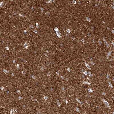 Immunohistochemistry-Paraffin: PACS1 Antibody [NBP1-90439]