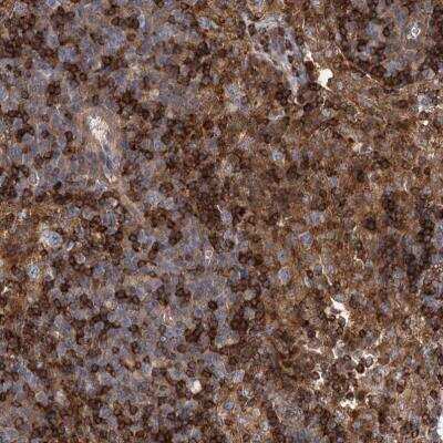 Immunohistochemistry-Paraffin: PACS1 Antibody [NBP1-90439]