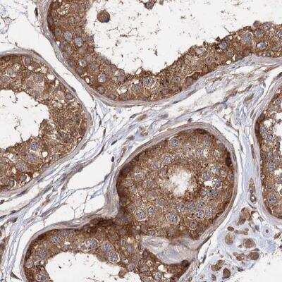 Immunohistochemistry-Paraffin: PACS1 Antibody [NBP1-90439]