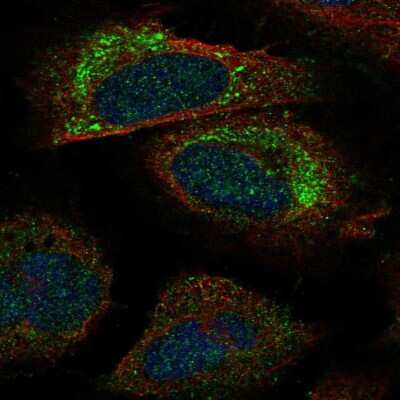 Immunocytochemistry/ Immunofluorescence: PACS2 Antibody [NBP2-58824]