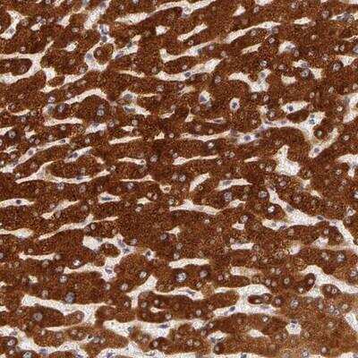 Immunohistochemistry-Paraffin: PACS2 Antibody [NBP1-81496]