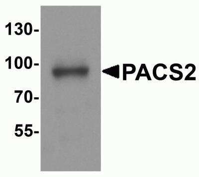 Western Blot: PACS2 AntibodyBSA Free [NBP2-81975]