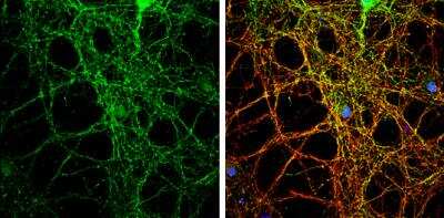 Immunocytochemistry/ Immunofluorescence: PACSIN1 Antibody [NBP1-32324]