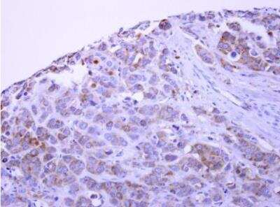 Immunohistochemistry-Paraffin: PACSIN1 Antibody [NBP1-32324]
