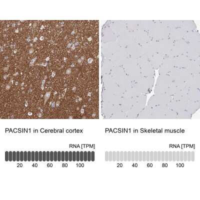 Immunohistochemistry-Paraffin: PACSIN1 Antibody [NBP1-87067]