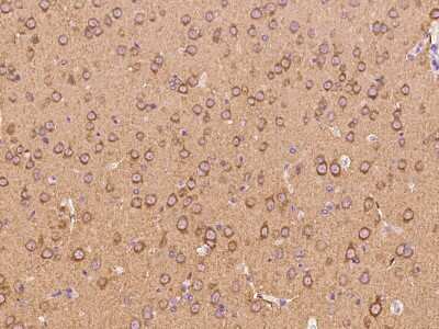 Immunohistochemistry-Paraffin: PACSIN1 Antibody [NBP2-99230]