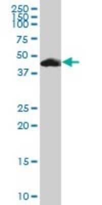 Western Blot: PACSIN1 Antibody [H00029993-B01P]