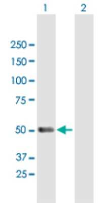 Western Blot: PACSIN1 Antibody [H00029993-B01P]