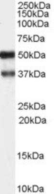 Western Blot: PACSIN1 Antibody [NB100-861]