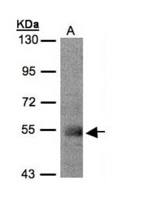 Western Blot: PACSIN1 Antibody [NBP1-32324]