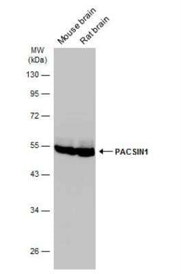 Western Blot: PACSIN1 Antibody [NBP1-32324]