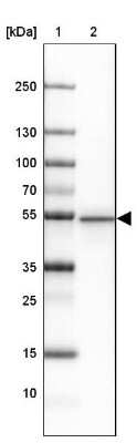 Western Blot: PACSIN1 Antibody [NBP2-33756]