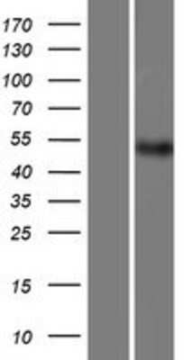 Western Blot: PACSIN1 Overexpression Lysate [NBP2-06588]