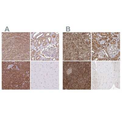 Immunohistochemistry-Paraffin: PACSIN2 Antibody [NBP2-13723]