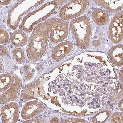 Immunohistochemistry-Paraffin: PACSIN2 Antibody [NBP2-13723]