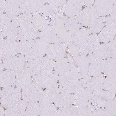 Immunohistochemistry-Paraffin: PACSIN2 Antibody [NBP2-13723]