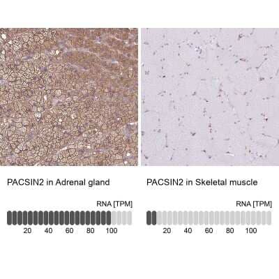 Immunohistochemistry-Paraffin: PACSIN2 Antibody [NBP2-13723]