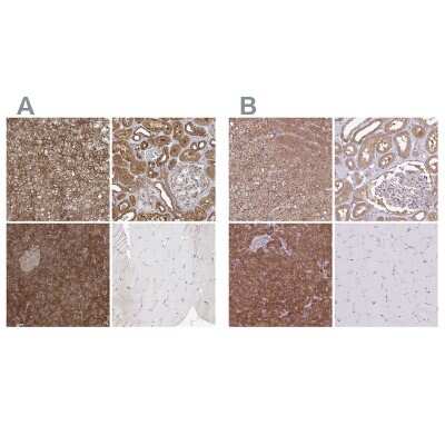 Immunohistochemistry-Paraffin: PACSIN2 Antibody [NBP2-56701]