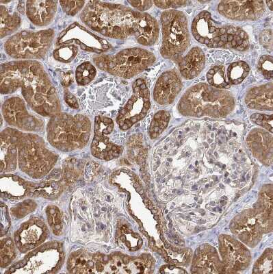 Immunohistochemistry-Paraffin: PACSIN2 Antibody [NBP2-56701]