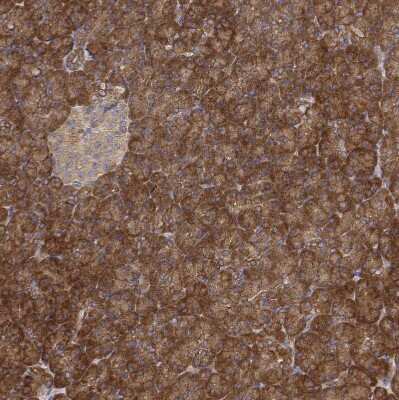 Immunohistochemistry-Paraffin: PACSIN2 Antibody [NBP2-56701]