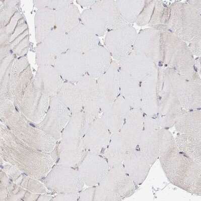 Immunohistochemistry-Paraffin: PACSIN2 Antibody [NBP2-56701]