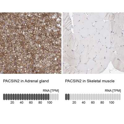 Immunohistochemistry-Paraffin: PACSIN2 Antibody [NBP2-56701]