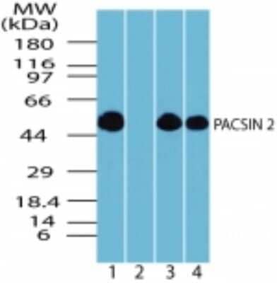 Western Blot: PACSIN2 Antibody [NBP2-24481]