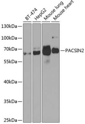 Western Blot: PACSIN2 AntibodyBSA Free [NBP2-94160]