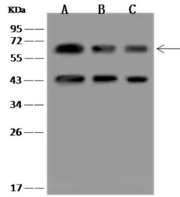 Western Blot: PACSIN2 Antibody [NBP3-06469]